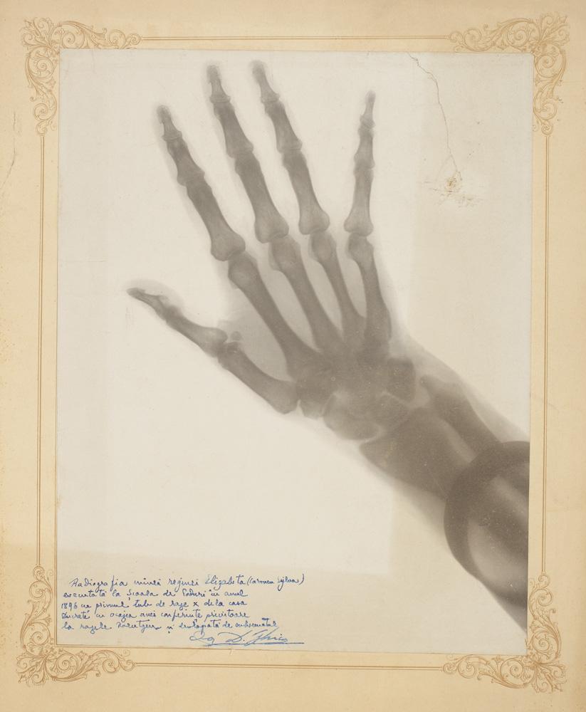 radiografia mâinii drepte a Reginei Elisabeta