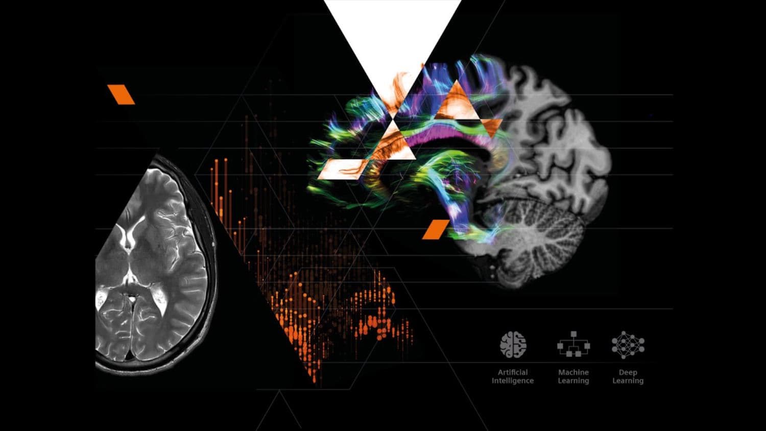 Siemens Healthineers shows potential of generative AI in medical technology