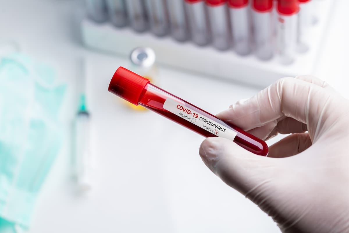 RO Govt. estimates over 1,200 daily coronavirus cases mid-August if growth trend persists