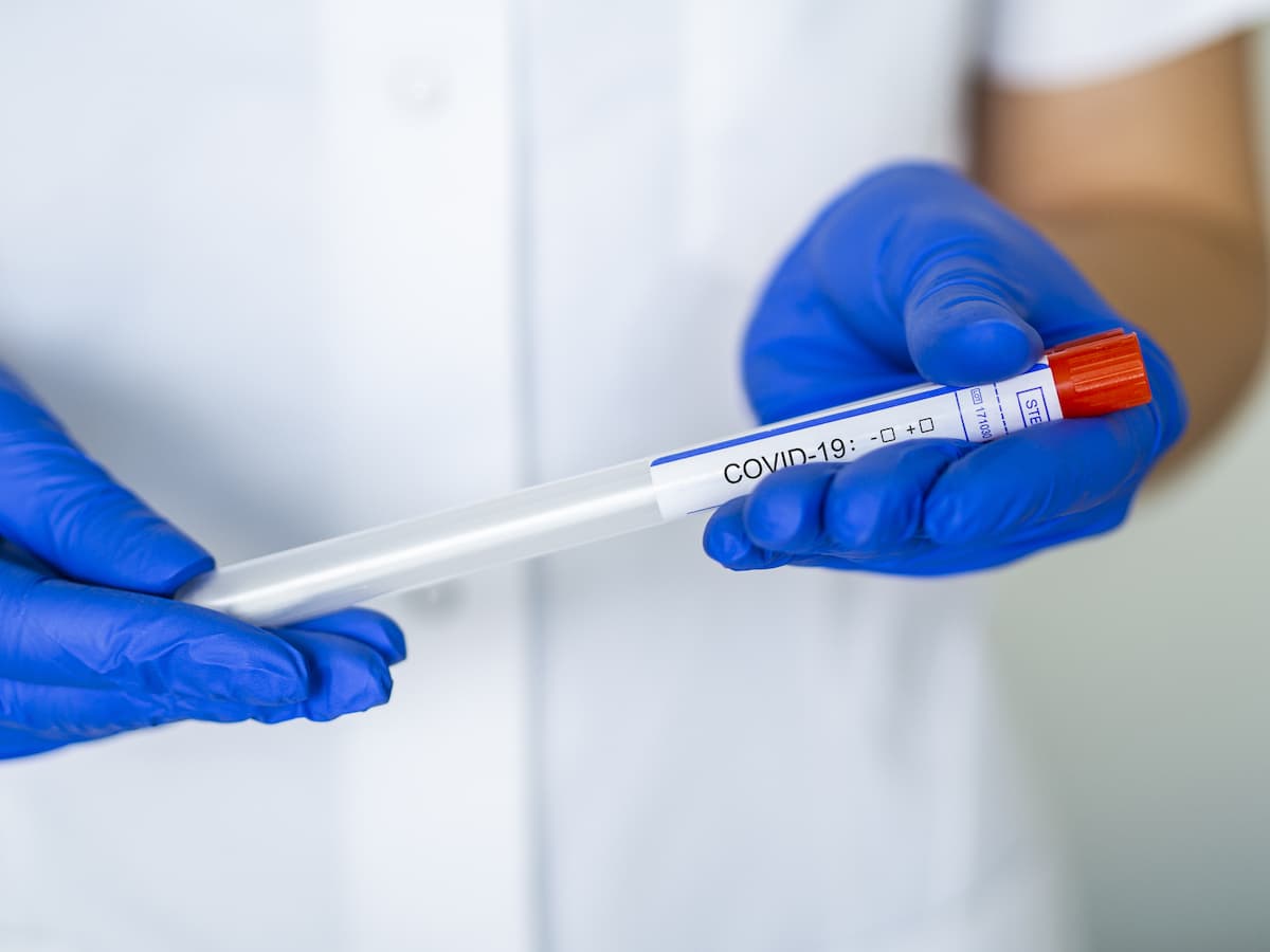 Romania records 388 coronavirus cases in 24 hours, total nears 27,000