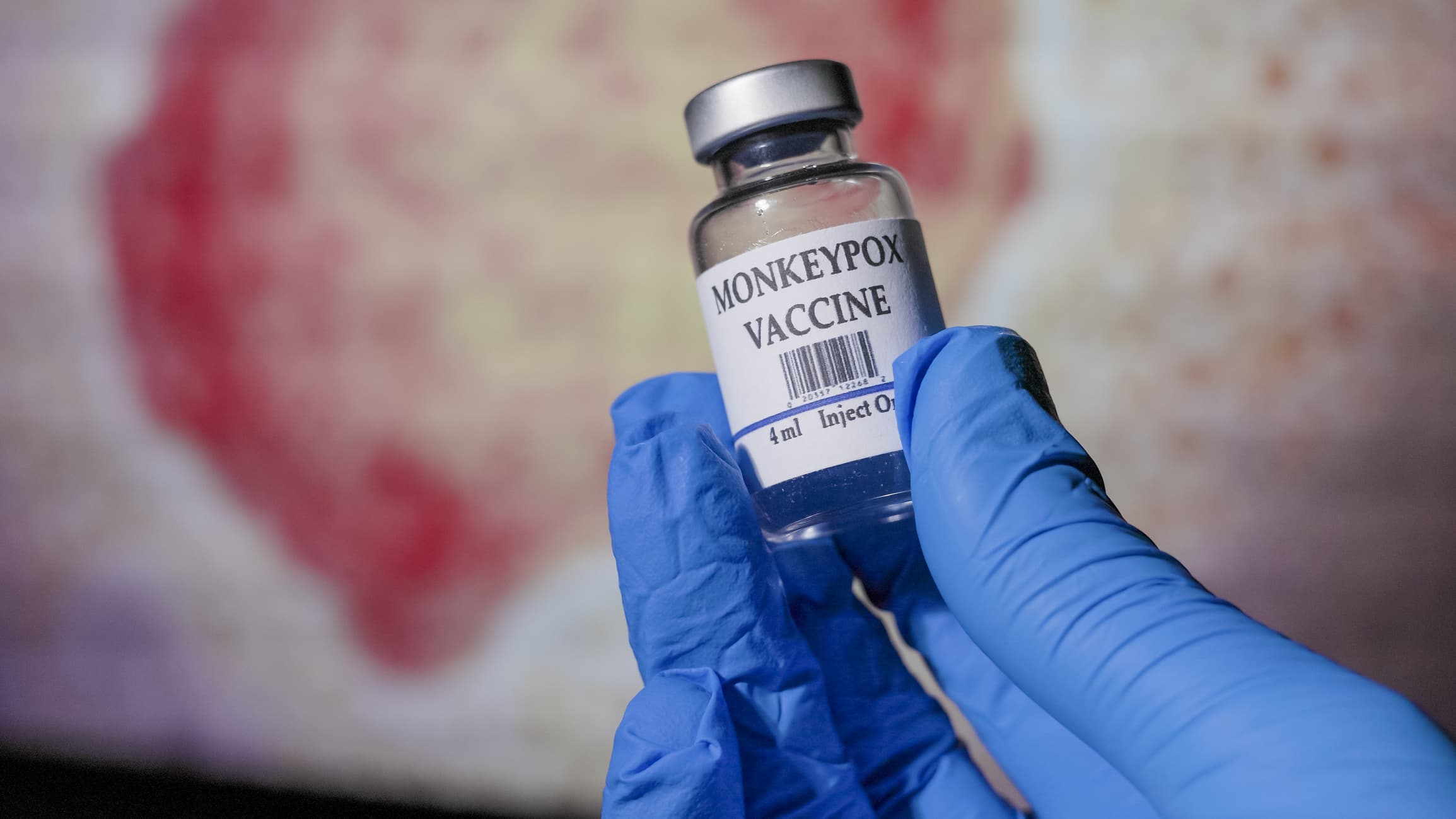 Romania receives 5,000 monkeypox vaccines