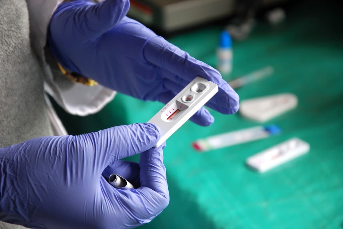 International Testing Week: Romanian Anti-AIDS Association holds free HIV, Hepatitis tests in Bucharest, Cluj, Iasi