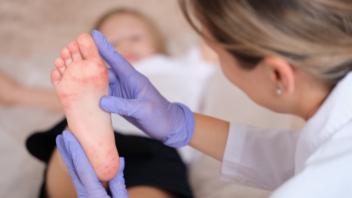Social Monitor: Low vaccination coverage fuels alarming measles surge in Romania
