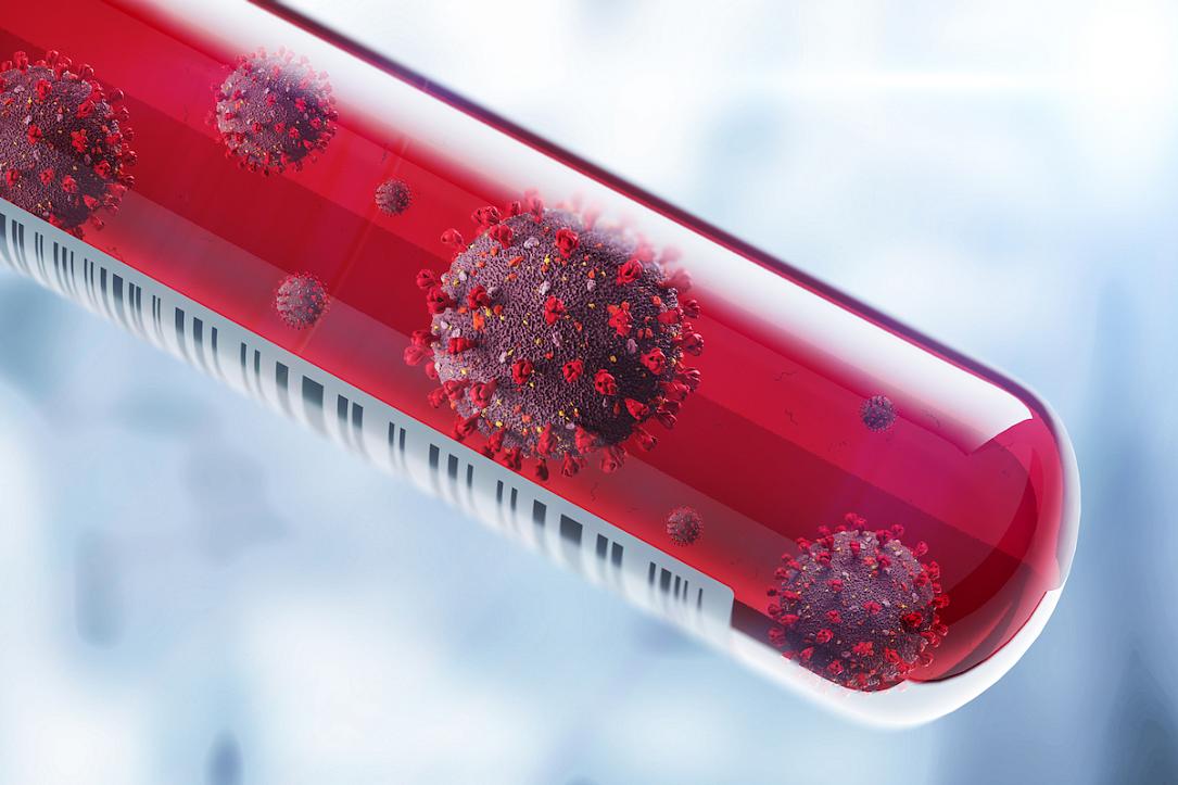 Coronavirus In Romania And The World Situation Summary
